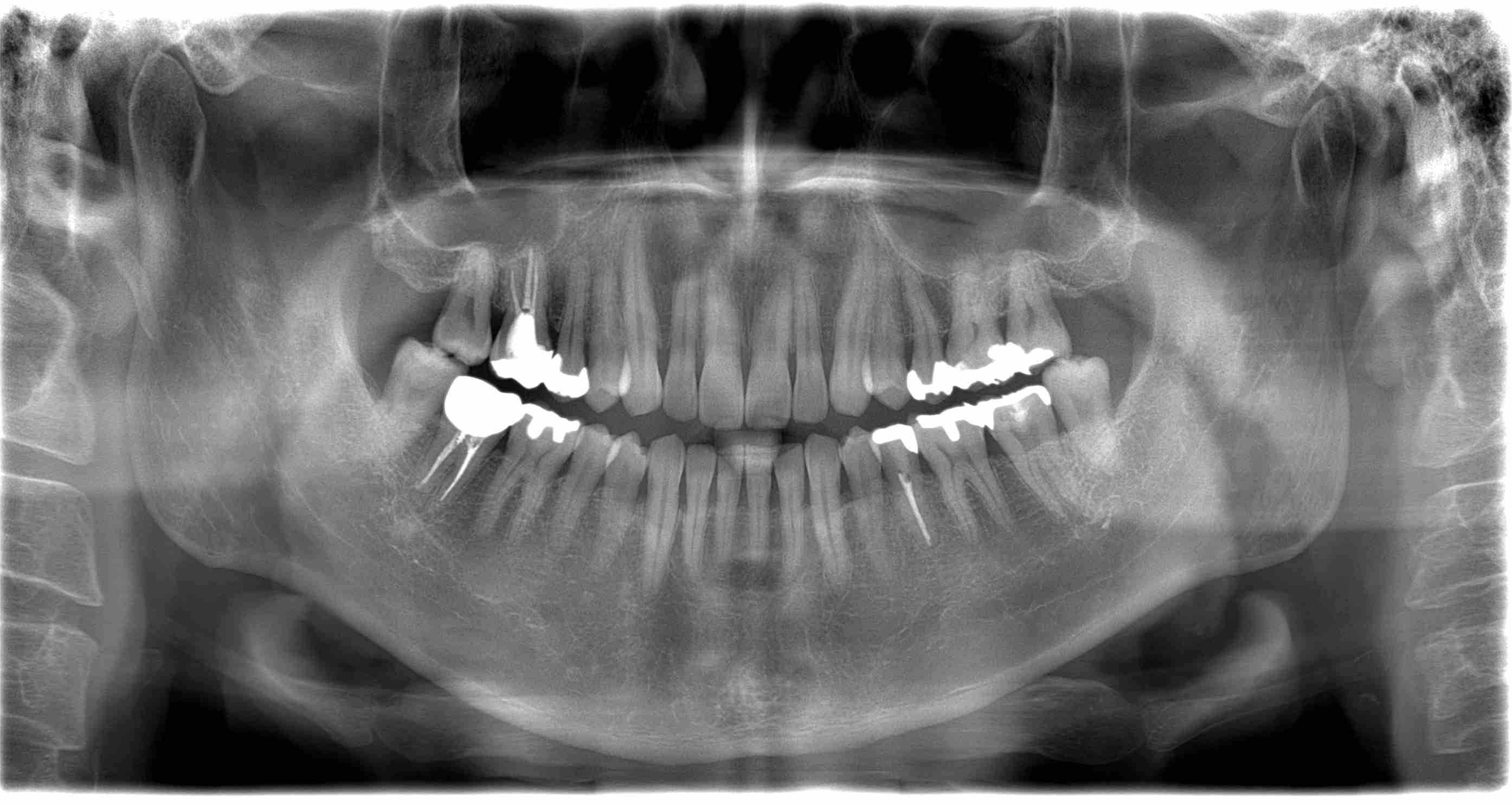 Veraview 3D X800