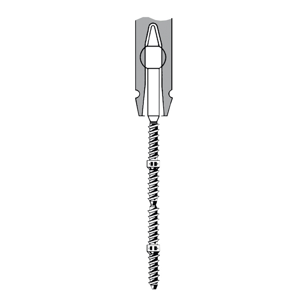 TMS Link plus Doppelstifte Minim Titan 0,525 mm silber 24 Stück + Zubehör, Set