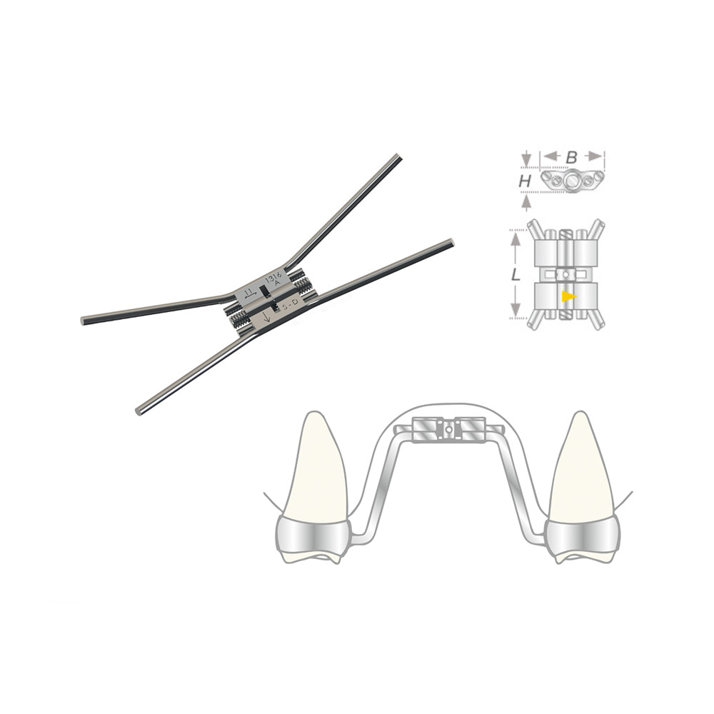 Vector 620 Gaumennahtschraube, Stück